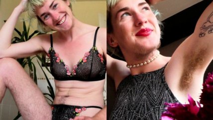   Mujer dejó de depilarse por completo y denuncia que la comparan con 