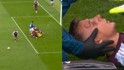   [VIDEO] Defensa de Aston Villa terminó con impactante chichón tras choque con 