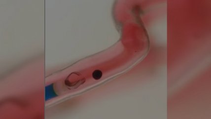   Crean nanorrobots que liberan fármacos en el lugar exacto y evitan efectos secundarios 