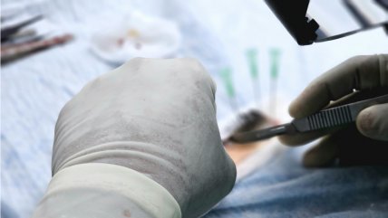  La explicación del Minsal por fallido traslado de hígado donado  
