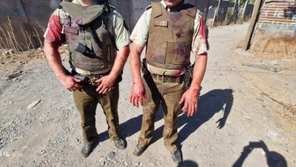   Delincuente agredió a su abuela y mordió a carabineros que fueron a detenerlo 