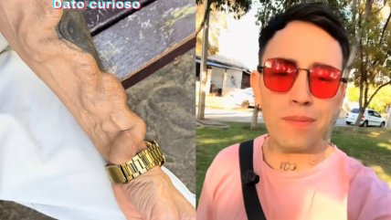   Joven terminó con secuelas en el brazo tras extraerse una muela infectada 